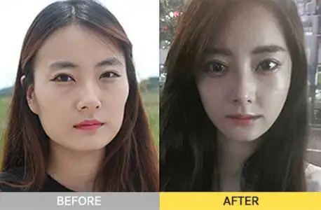 不如通过真人前后对比案例更加直观的了解吧!