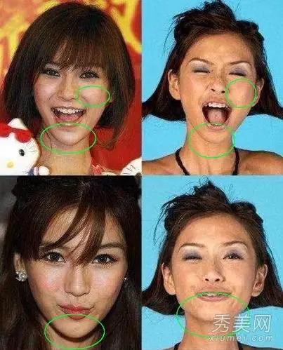 娱乐   【导读】女神angelababy参加中国版《跑男》,深陷"整容门"