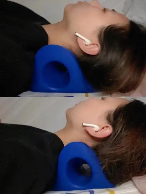 我整个人都是驼背并且脖子前倾,这一年以来一直用各种方法在矫正自己