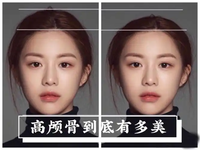 近两年流行的高颅顶审美.