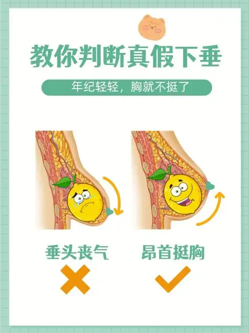 一图判断胸下垂程度真假下垂要分