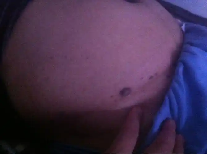 男人肚脐上方长痣好不好(男人肚脐上方长痣好不好图片)