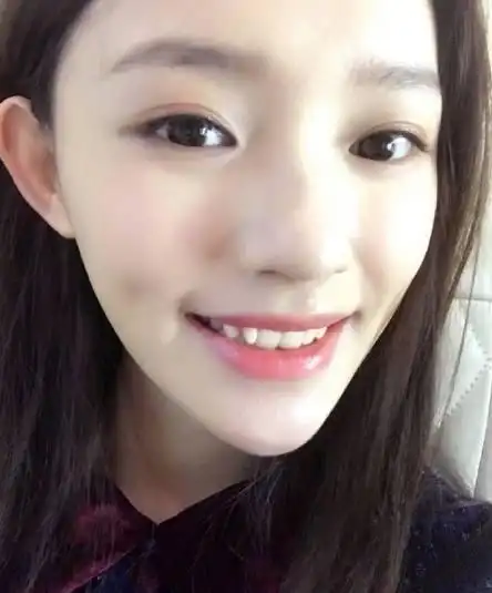 那些可爱的虎牙明星,马伊琍佟丽娅林允王俊凯刘昊然你喜欢哪一个_网易