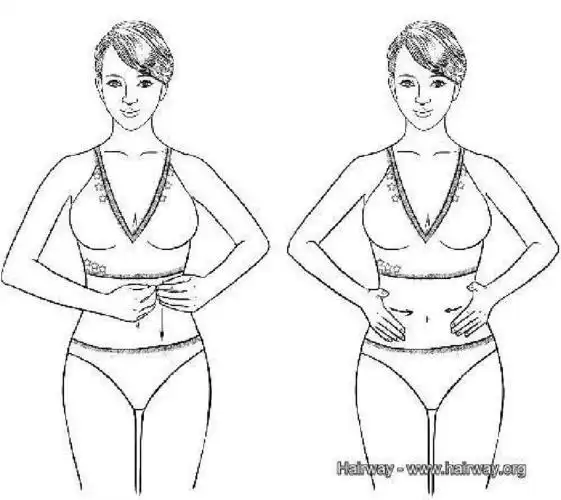 肚子大,湿气重,教你3招祛湿减肥,肚子平了,头发不油腻