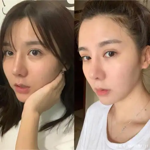 美丽资产烟酰胺安瓶精华液,一个"宝藏"去黄美白神器