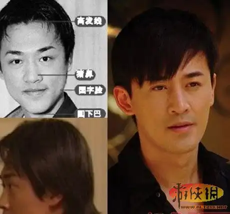 杨幂林峰领衔 盘点那些整容就大红大紫的明星