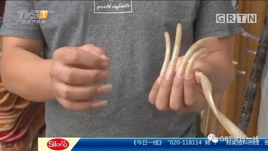 13厘米长指甲!男子留了8年!每次护理花费千元,竟是因为