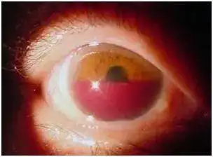 健康科普重视儿童眼外伤