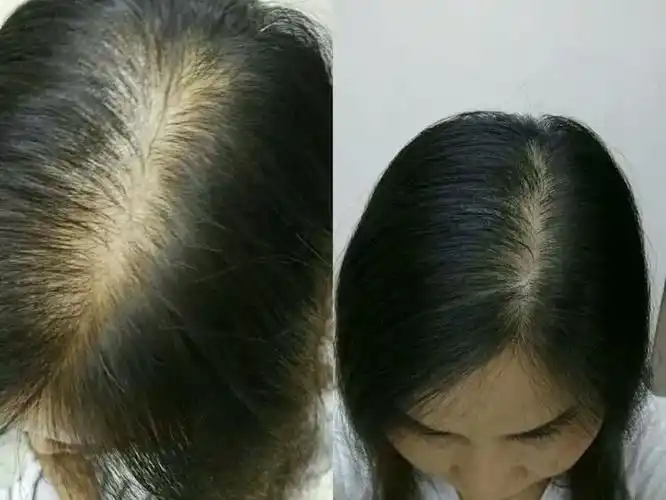 祖传纯中草药生发固发乌发液 - 美篇