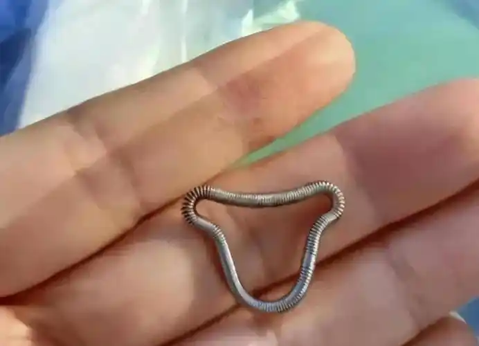 v形环,母体乐等种类的节育环使用年限是5至8年,t型环和含铜宫型环