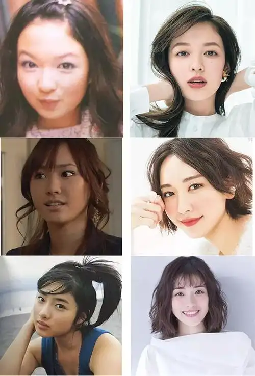 又想骗我去日本整容这些女星的前后对比也太夸张了吧