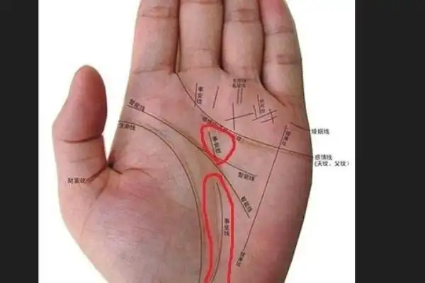 事业线是哪一条