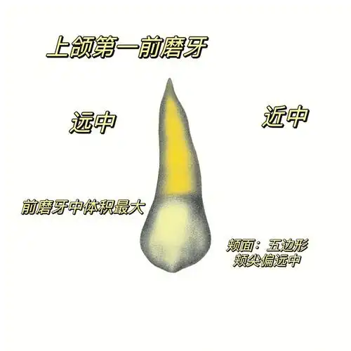 口解四 上颌第一前磨牙