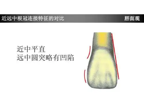 上颌中切牙形态特征简述ppt