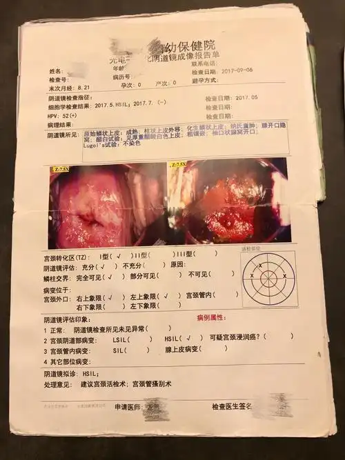 女性福音臻谧抑菌凝胶,各类妇科病炎症轻松治愈