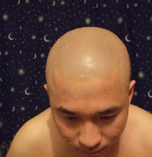 发几张清晰的光头图