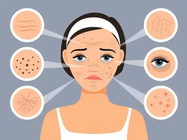 8,如何通过饮食和护肤来缓解电脑族脸上的皮肤问题?