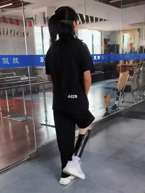 假肢女孩
