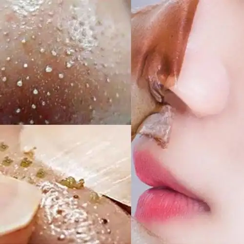 去脏脸神器 撕出脏东西 面部深层清洁污垢脸部去毛孔垃圾清洁膏