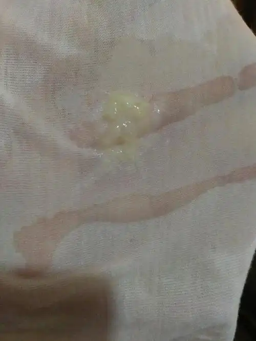 孕39 1宝宝没有发动的意思,今晚洗澡内裤上有这样的分泌物,各位宝妈是