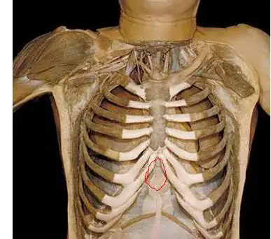 按胸口中间疼是怎么回事