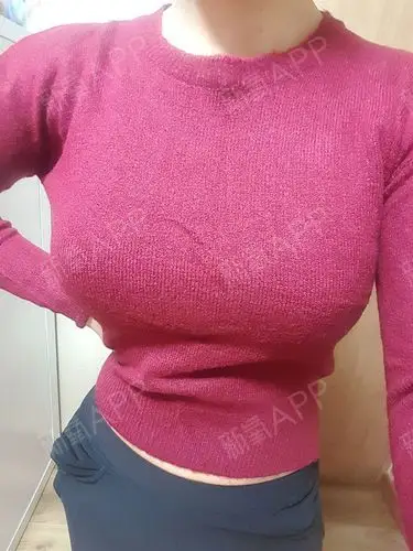 假体隆胸好不好_效果图_ざわざわ多い雪假体隆胸术后第116天_新氧美容