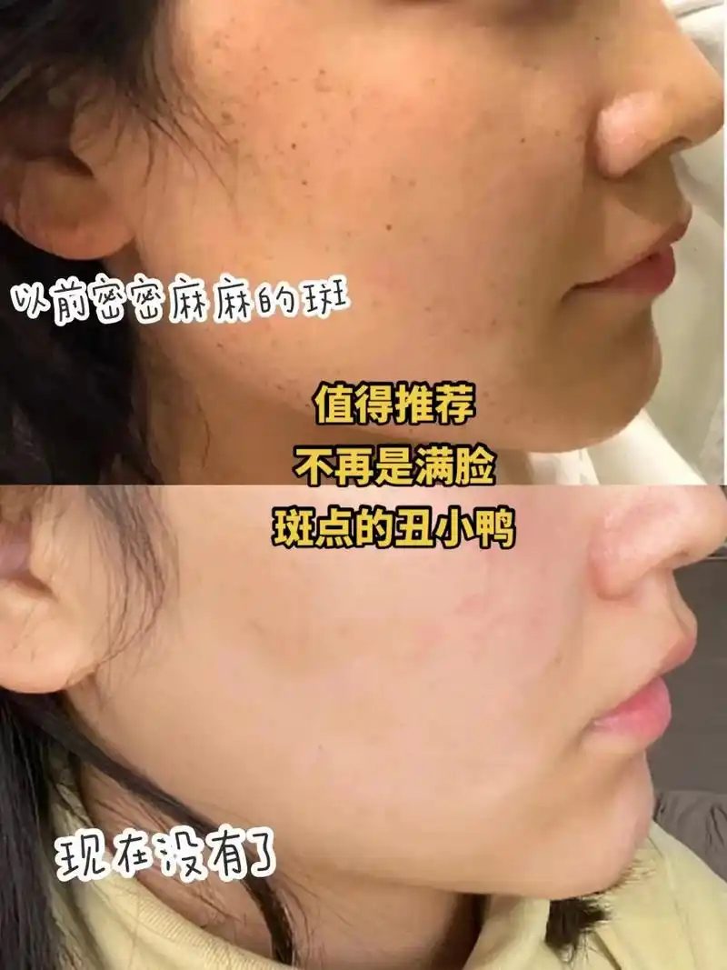 皮肤蜡黄,暗沉,肤色不均 - 抖音