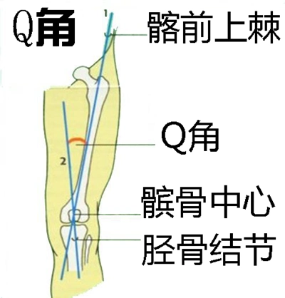 跑步膝,专业业余有差,男性女性有别.业余爱好者出现的概率比专业的大.