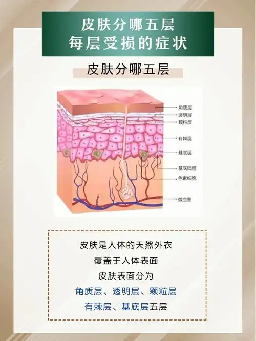 皮肤分哪五层每层受损有哪些症状