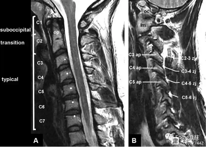 图示:矢壮位mri显示的颈椎结构和区域.白点:为上位椎屈伸运动中心.