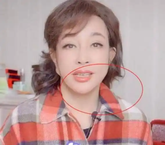 70岁刘晓庆"面具脸"太雷人,耳垂下巴都连在一起,能不能真实点_耳朵