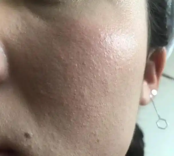 婚后皮肤缺水的女人,脸上有3个表现,一定要重视,不要追悔莫及