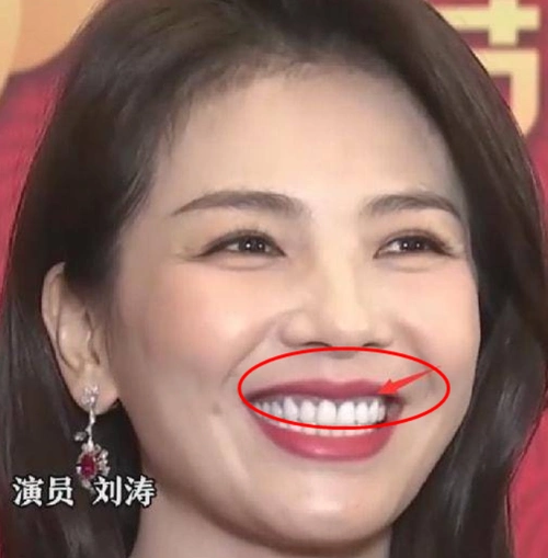 整容换脸,假牙,假发,假屁股,这些明星身上还有什么是真的