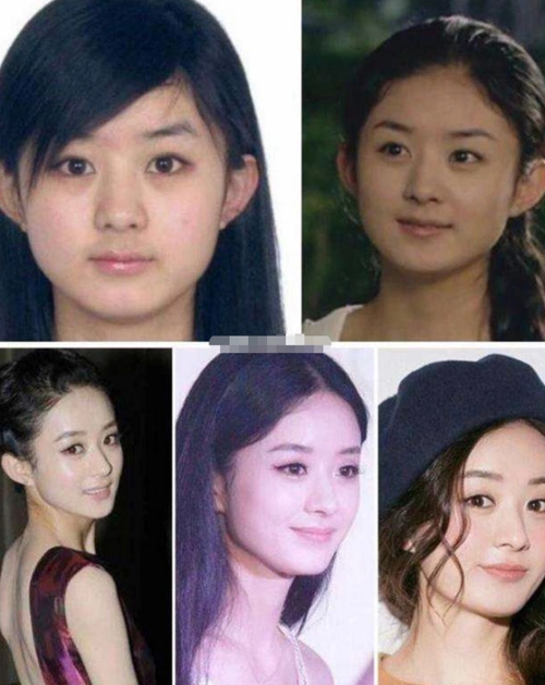 赵丽颖产前产后像换头五官气质变化明显前后判若两人