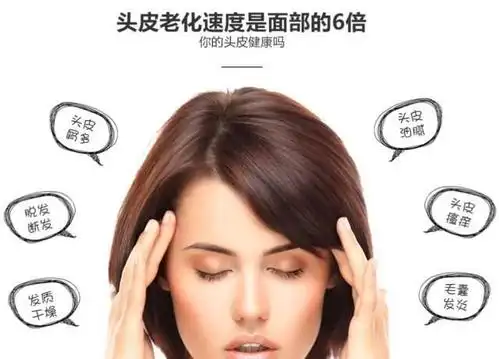 头皮问题导致的结果