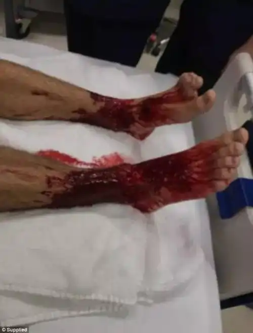 注意丨到海边玩留意这个东西,看到了立刻跑开