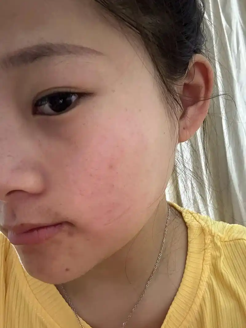 原相机的自己 有什么可以拯救一下我 这张脸,我的已经过敏了 - 抖音