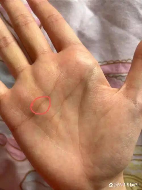 感情线上出现了岛纹,会有什么影响呢?