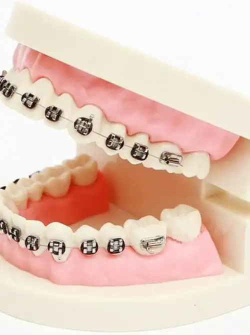 地包天怎么矫正呢?