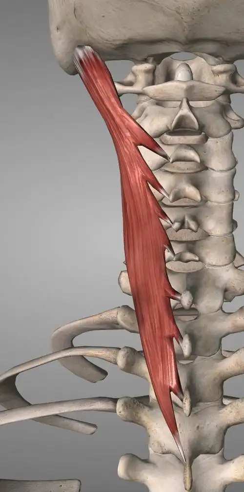 每日一肌:颈痛富贵包,后脑勺痛之夹肌
