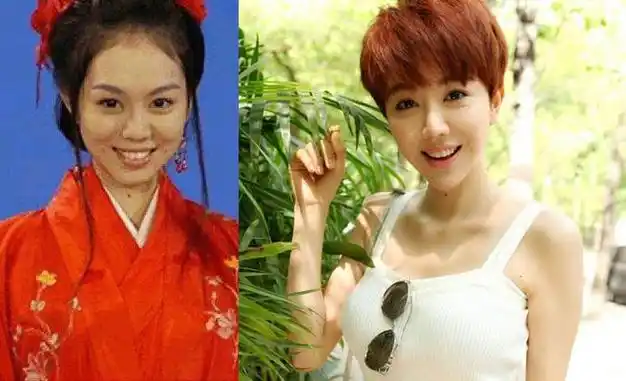 恕我直言金晨就是一张整容失败的脸