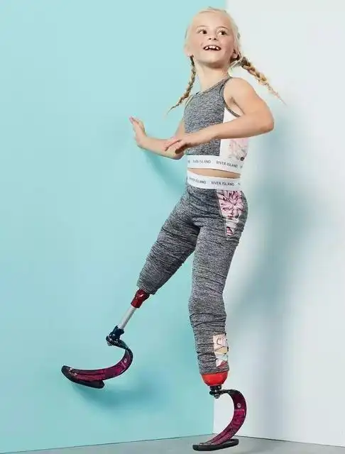 9岁小女孩天生没有腿,走t台美哭观众:看见脸就忘了她的腿