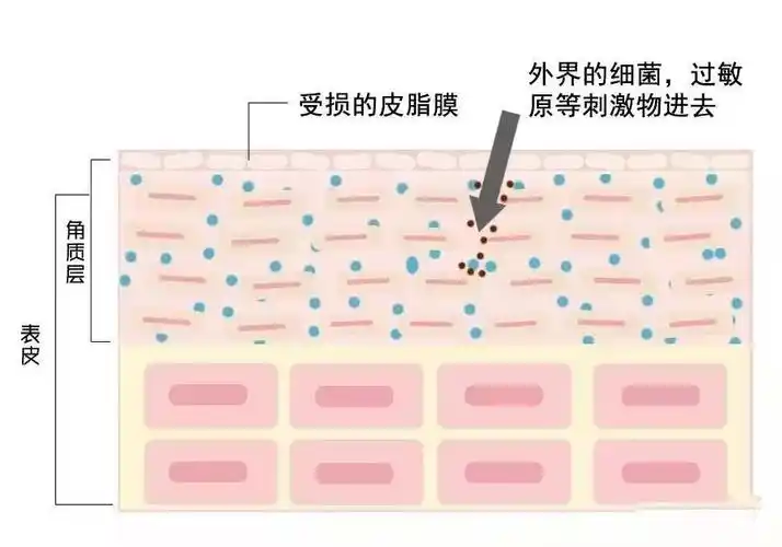 皮脂膜受损,缺失后,表皮层内的水分会经过漏洞的位置流失,皮肤就会