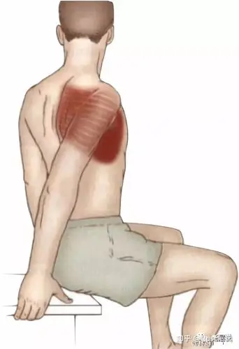 干货分享——前锯肌:胸胁苦满,英雄气短,还和"翼状肩胛"也有关.