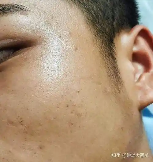 油皮,毛孔粗大的男生,用朗仕好还是碧欧泉好?