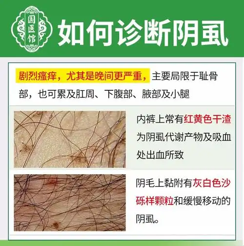 百部酊灭阴虱立净喷剂男士用女士私处大人虱子阴虱软膏苏季晓济 一
