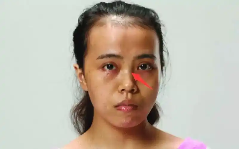 上下连通印堂与鼻宫,若是女人的山根有低陷,则这样的女人,好吃懒做