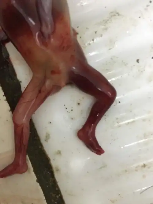 怀孕3个月,婴儿在腹中死亡,药流下来,想知道是男是女,这是第二胎