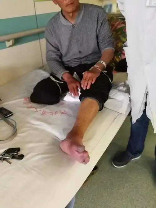 太吓人河北一男子双腿被截肢竟是因为你几乎也天天做