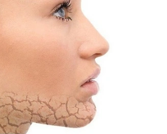 鱼鳞病为什么秋冬严重